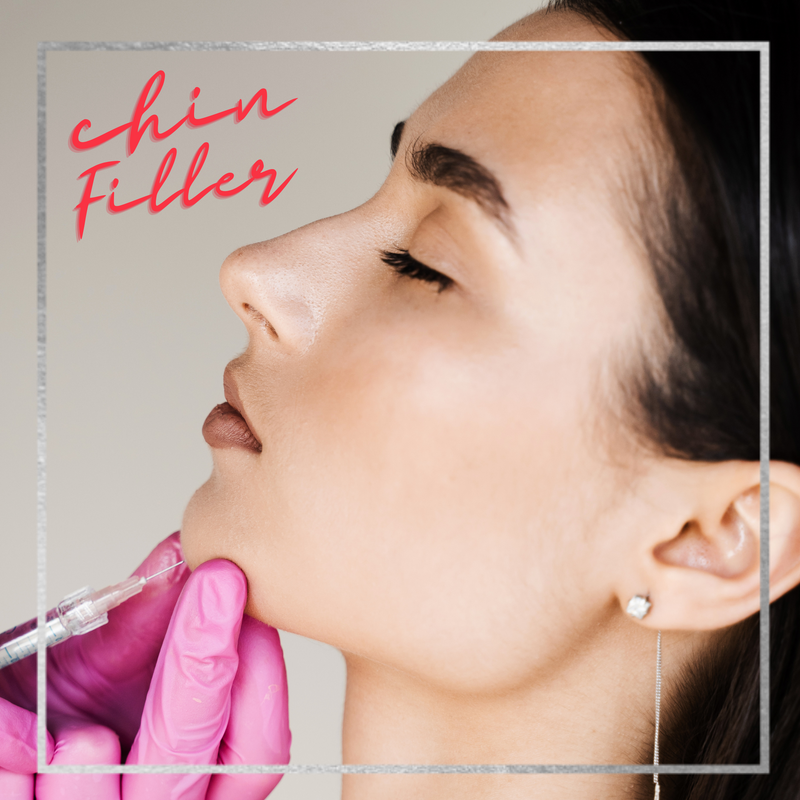 Natural Chin Filler